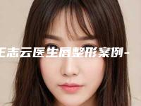 王志云医生唇整形案例-价格价位表2025报价大全
