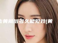 去黄褐斑多久能见效(黄褐斑和晒斑区别)