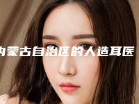 内蒙古自治区的人造耳医院推荐：人造耳医院前30强大汇合