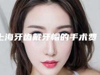 上海牙齿戴牙帽的手术费用一般要多少