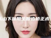 乐山下颌阻生智齿矫正术有什么副作用