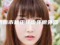 济南市矫正牙齿牙根外露口腔医生排名top10强不容错失-周聪医生知名度高口碑好