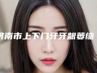 济南市上下门牙牙龈萎缩多少钱-济南市上下门牙牙龈萎缩医院上榜名单前十随心选