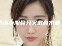 济南市股骨分叉截骨术最好的整形医院(济南星范医疗美容整形诊所位列前三)