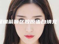 深圳前颞区胶原蛋白填充公立医院排名榜单（新）