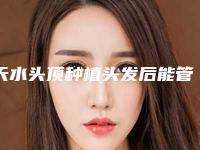 天水头顶种植头发后能管多久,天水头顶种植头发的作用能永久保持