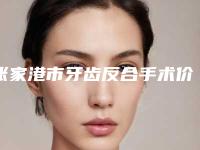 张家港市牙齿反合手术价格(价目)公布一份-近8个月均价为5963元