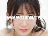 重庆半纹绣整容前后效果对比（近6个月重庆半纹绣效果满意度为：92%）