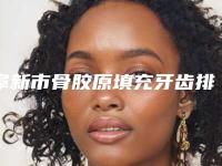 阜新市骨胶原填充牙齿排名榜前十位焕新啦-阜新市骨胶原填充牙齿口腔医生