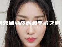 西双版纳皮肤病手术之后需要做什么护理