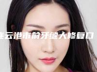 连云港市前牙缝大修复口腔医生排行榜近期全新公布-连云港市前牙缝大修复医生口碑技术点评_附价格一览表